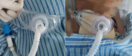 神经外科提升优质服务改善护理质量的举措(图2)